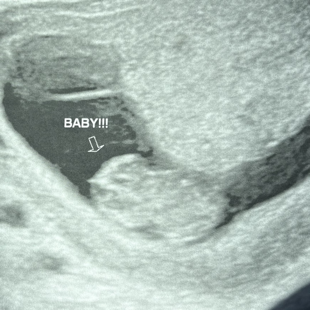 Photo shared by Dawndai for their Babylist baby registry.