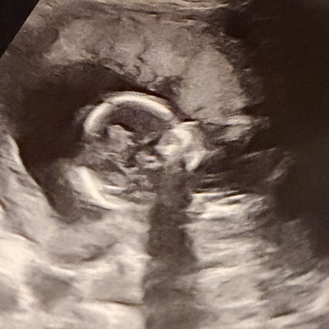 Photo shared by Dajdrion for their Babylist baby registry.