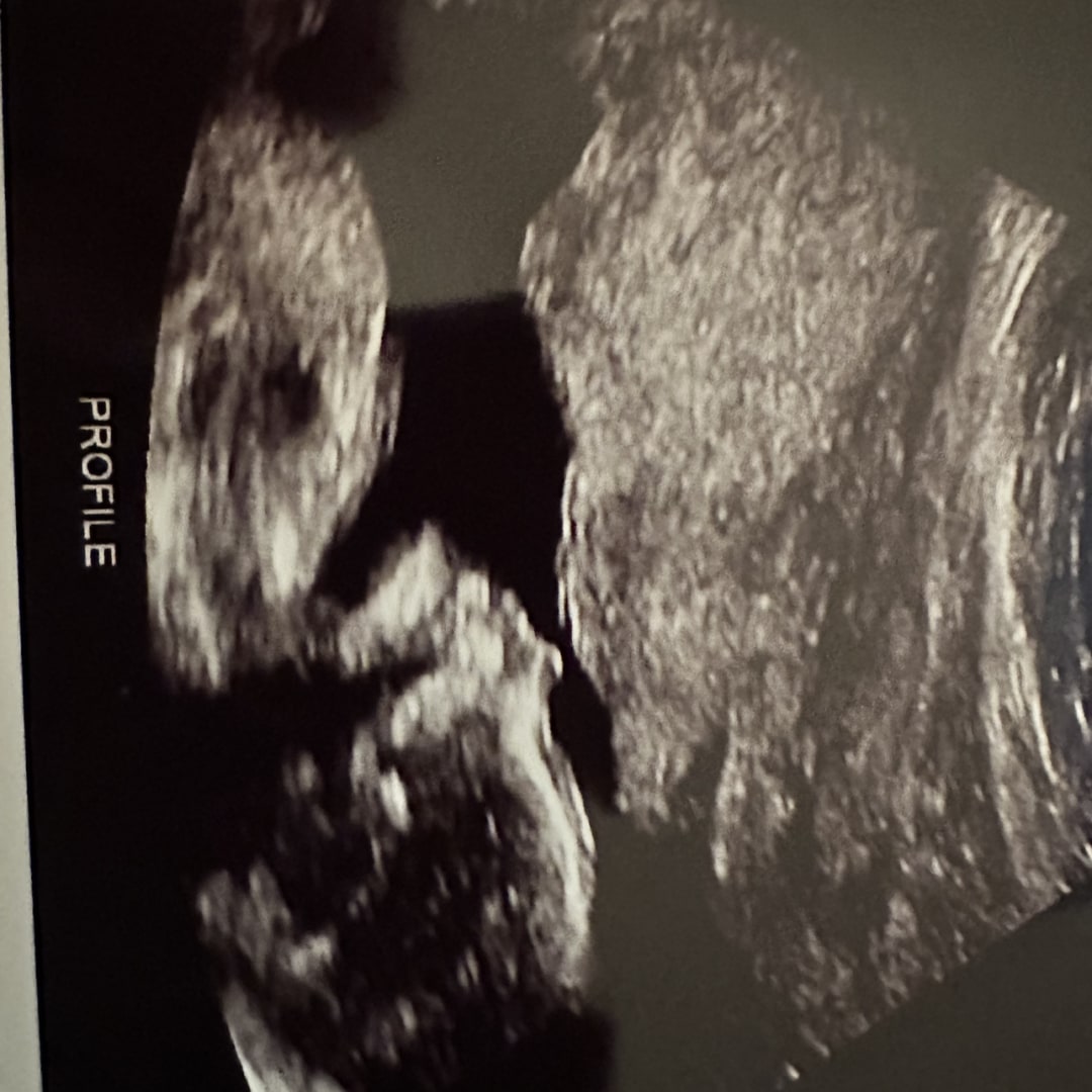 Photo shared by Andrea for their Babylist baby registry.