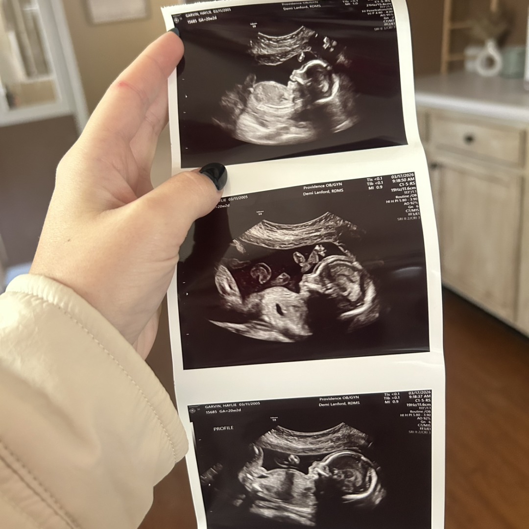 Photo shared by Haylie for their Babylist baby registry.