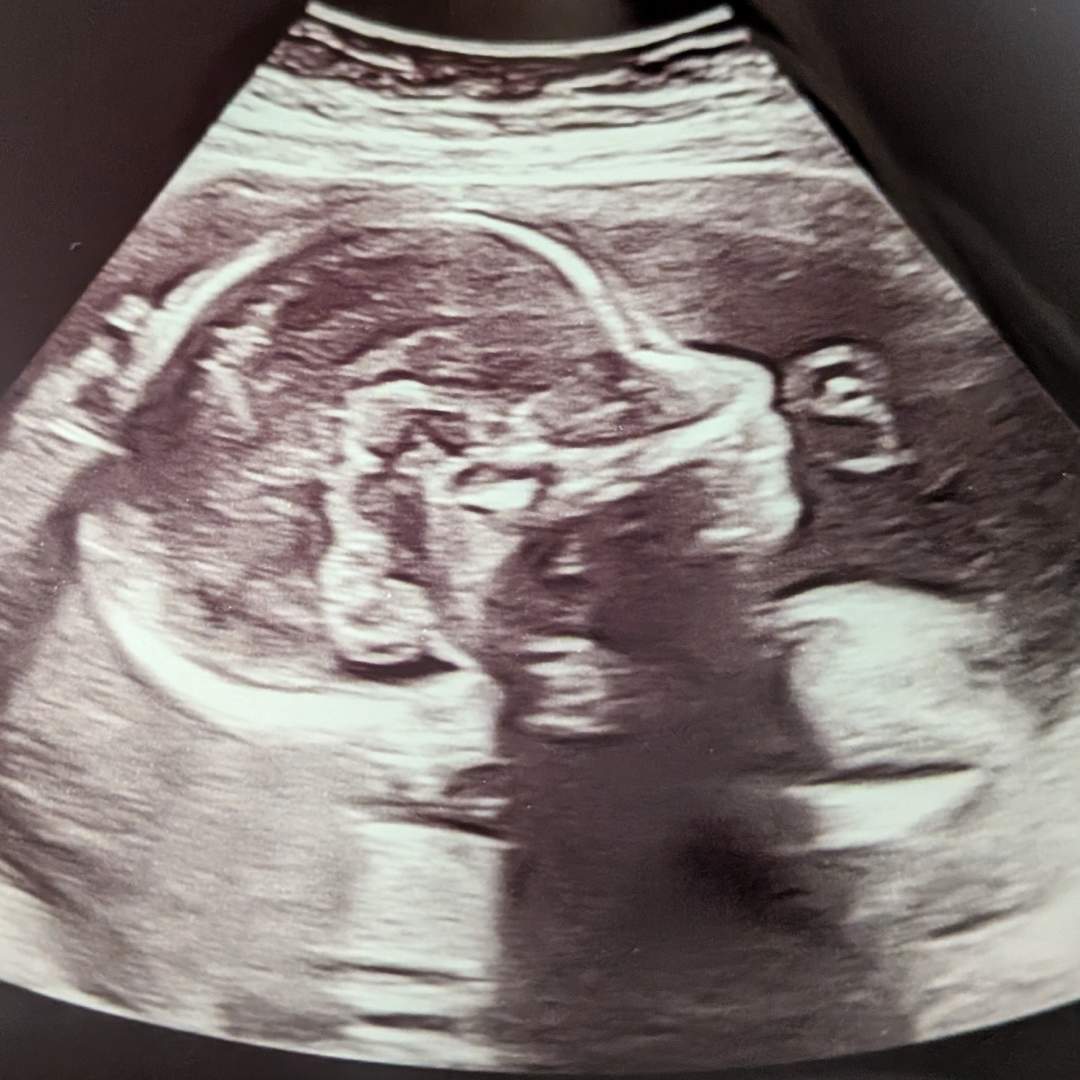 Photo shared by Emily for their Babylist baby registry.