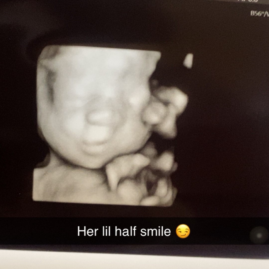 Photo shared by Johnna for their Babylist baby registry.