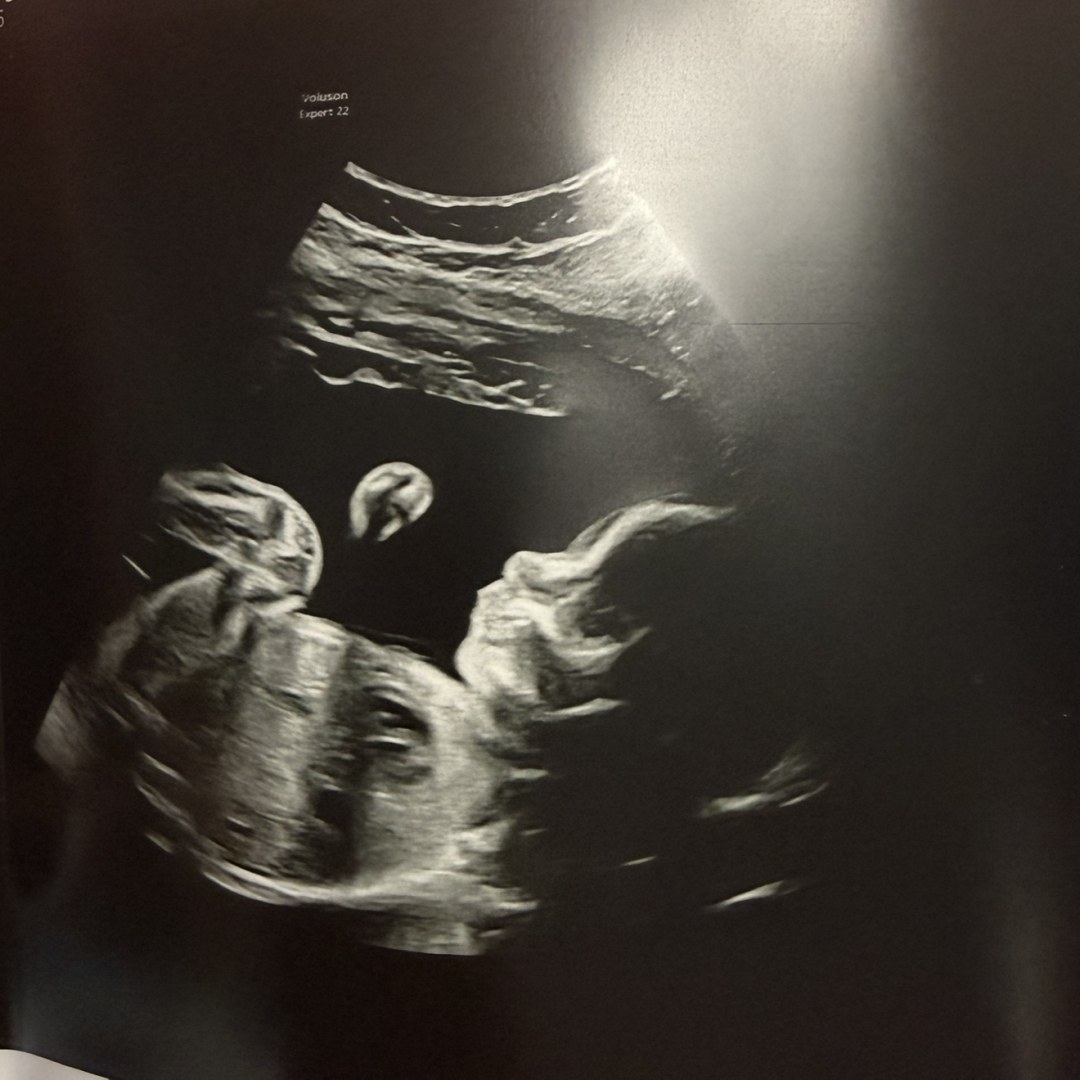 Photo shared by Agustina for their Babylist baby registry.