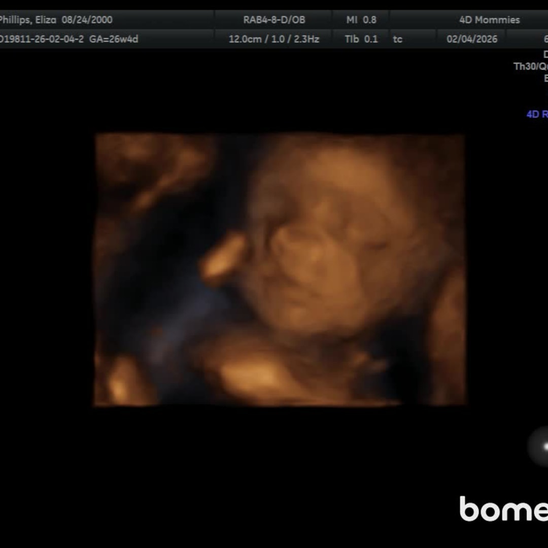 Photo shared by Eliza for their Babylist baby registry.