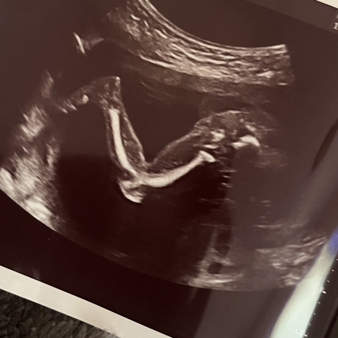 Photo shared by Jaylen for their Babylist baby registry.