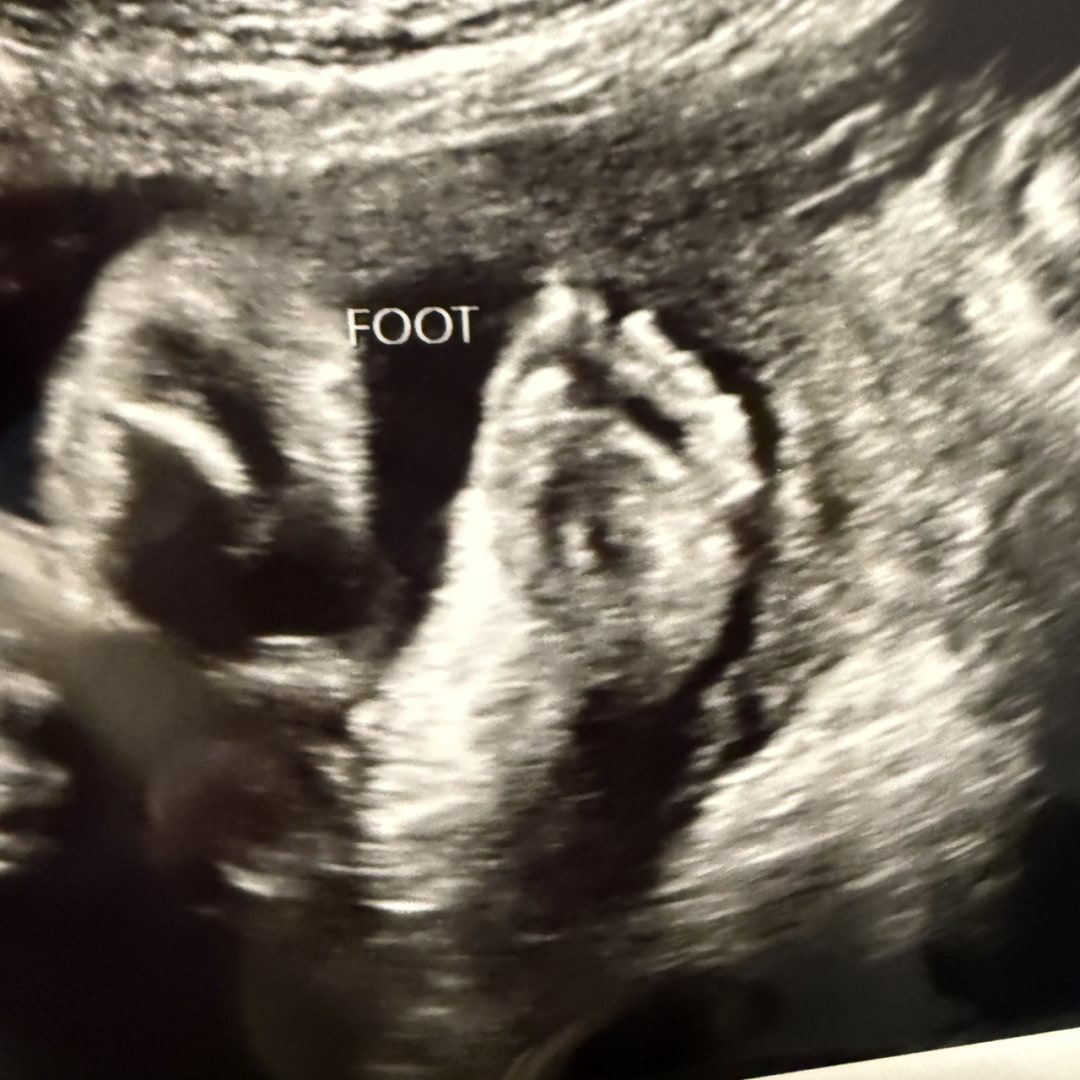 Photo shared by Priscilla for their Babylist baby registry.
