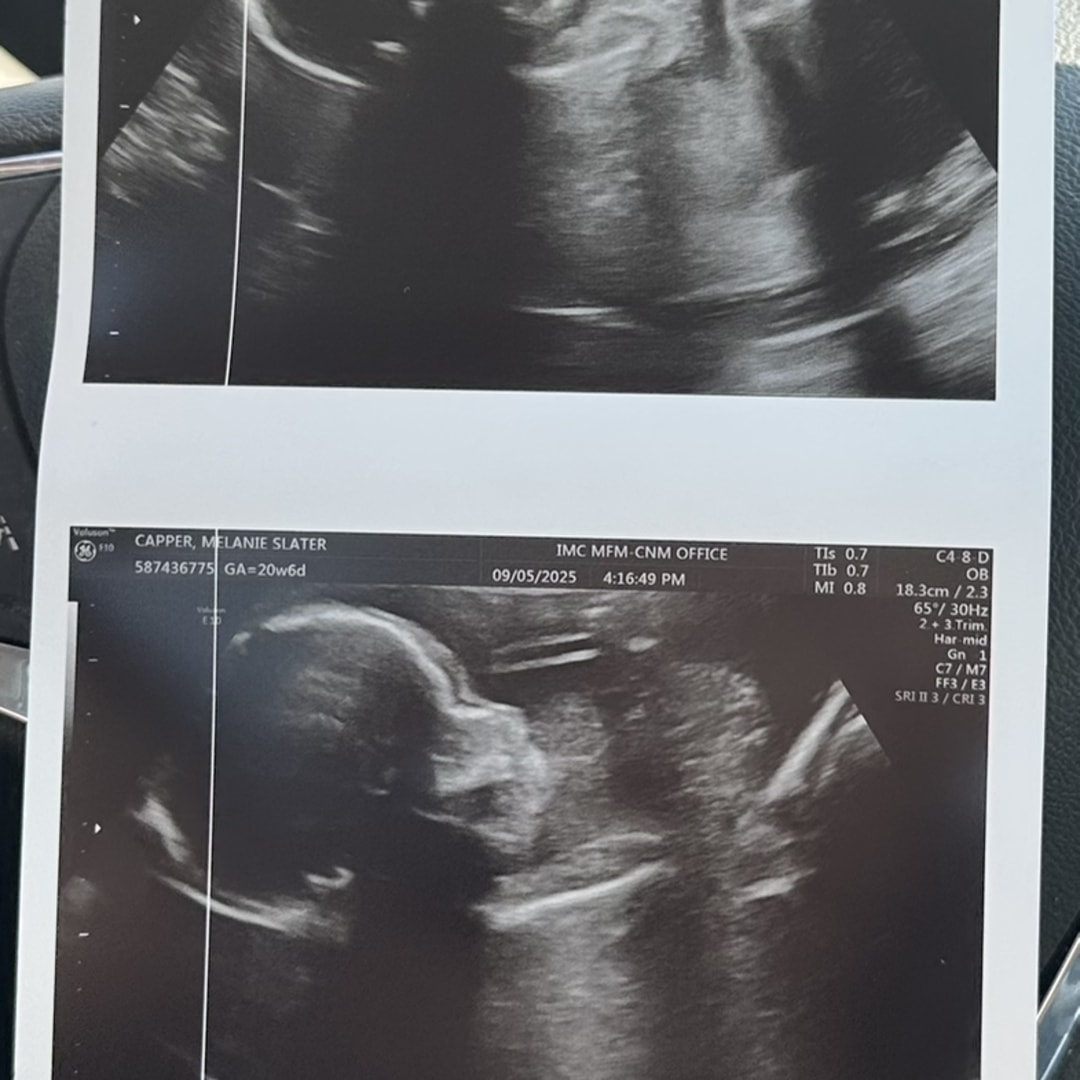 Photo shared by Melanie for their Babylist baby registry.