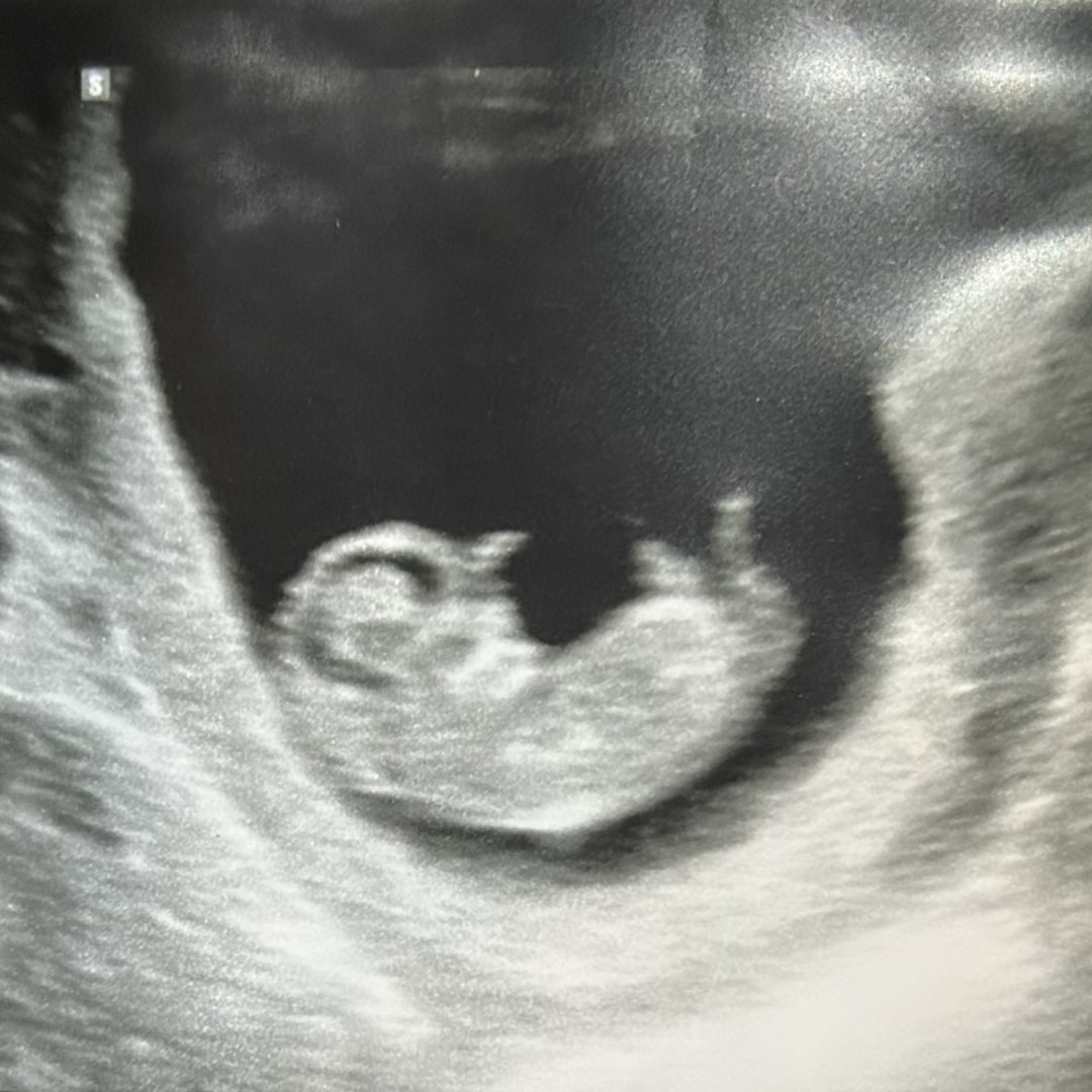 Photo shared by Brooklyn for their Babylist baby registry.