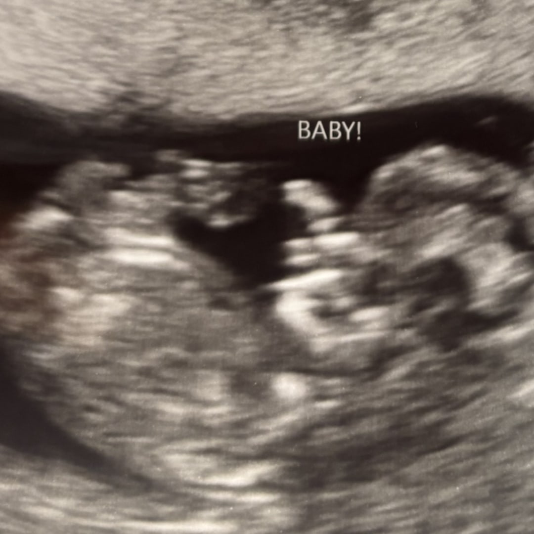 Photo shared by Hailey for their Babylist baby registry.