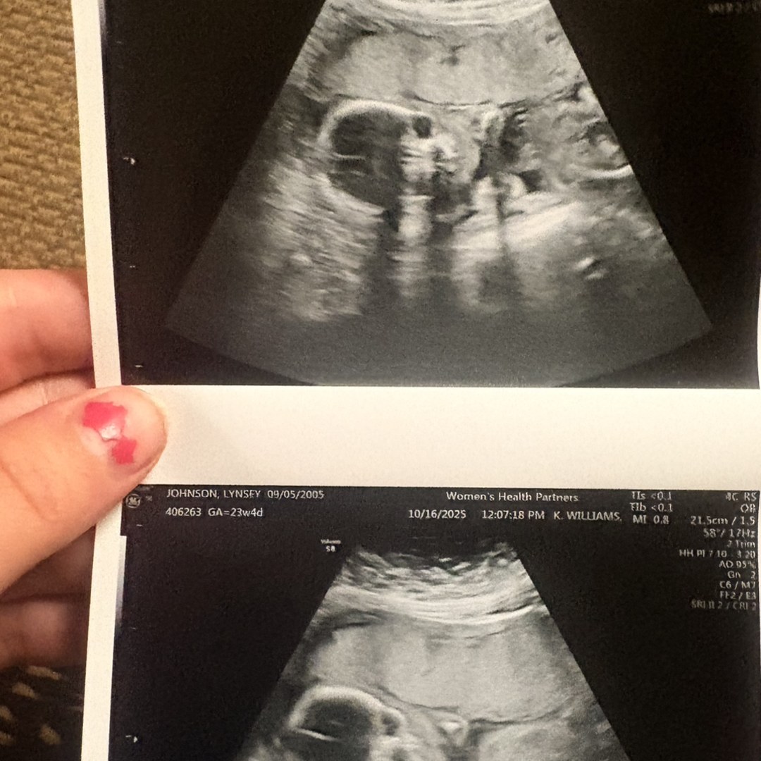 Photo shared by Lynsey for their Babylist baby registry.