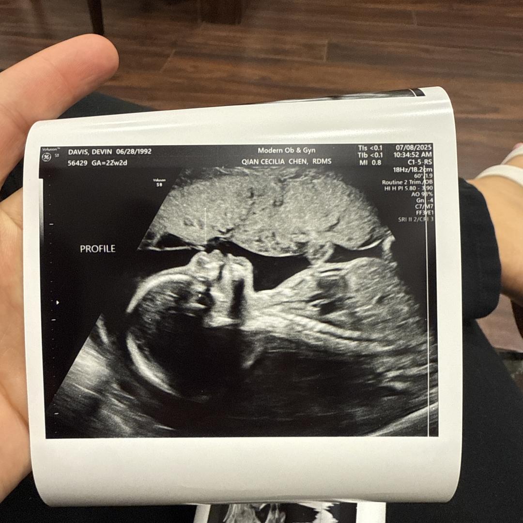 Photo shared by Devin for their Babylist baby registry.