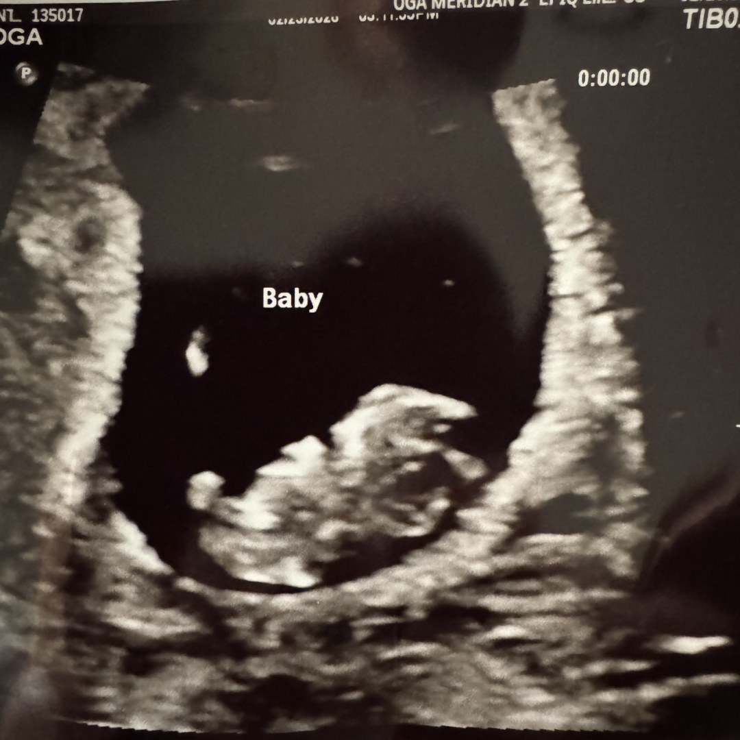 Photo shared by Samantha for their Babylist baby registry.