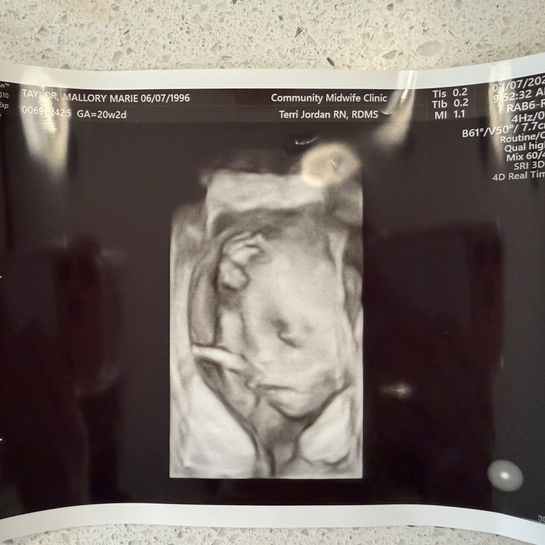 Photo shared by Mallory for their Babylist baby registry.
