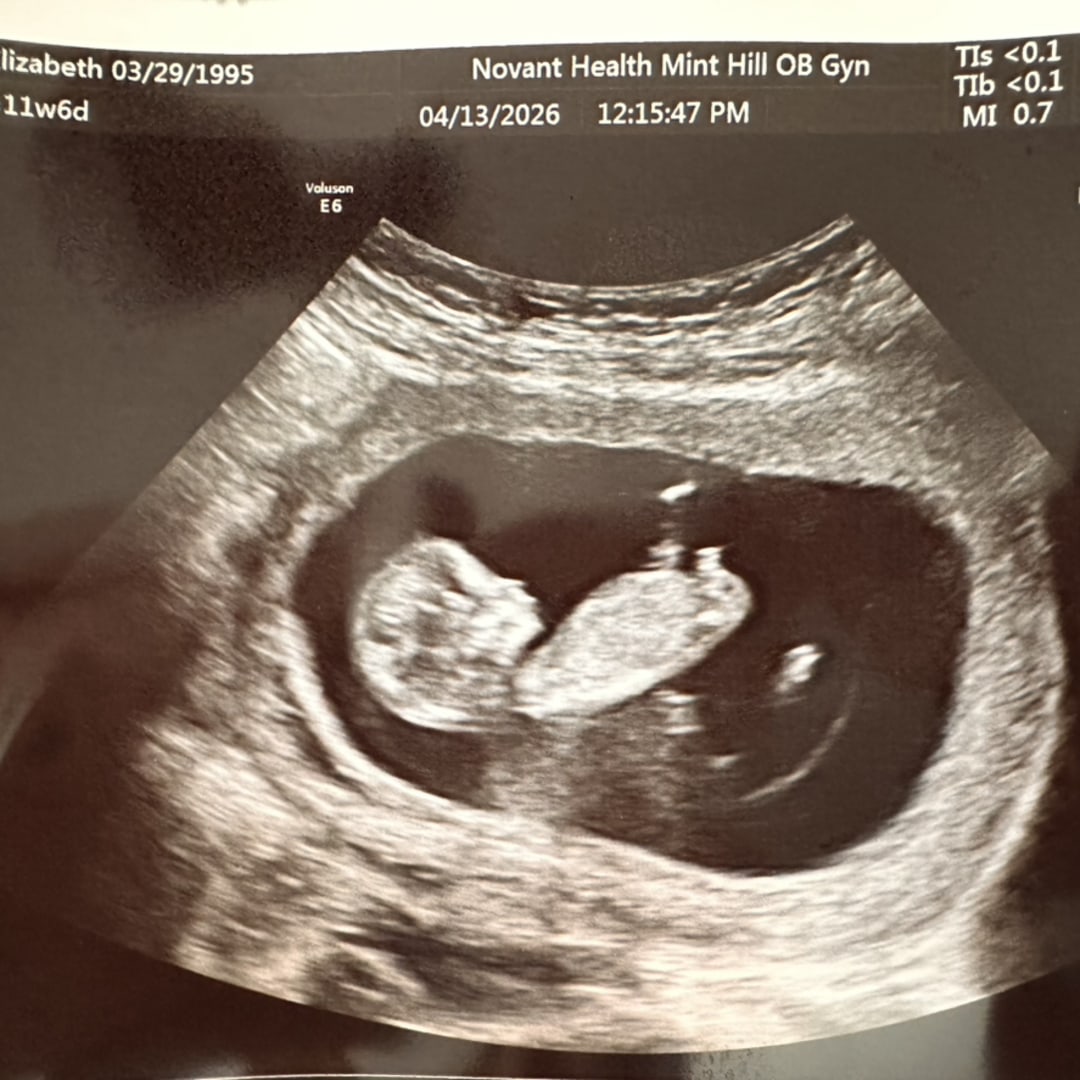 Photo shared by Kaitlynn for their Babylist baby registry.