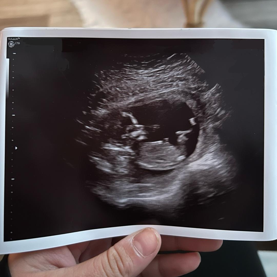 Photo shared by Bryanna for their Babylist baby registry.