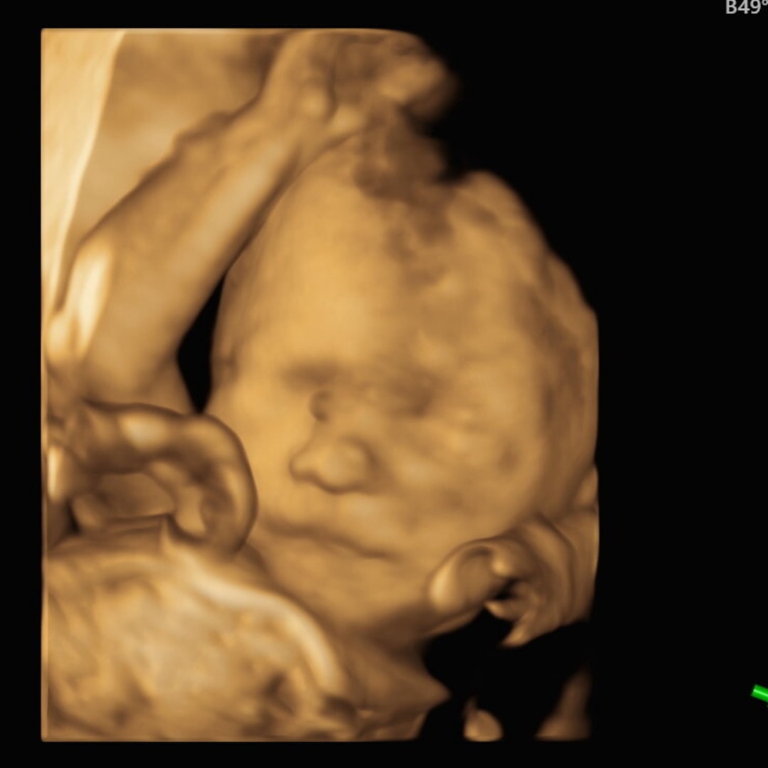 Photo shared by Alexa for their Babylist baby registry.