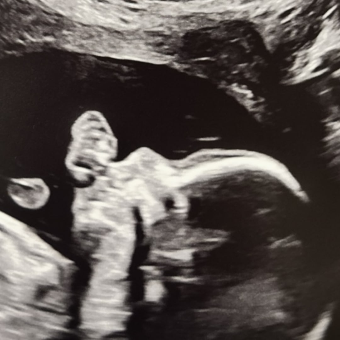 Photo shared by Tara for their Babylist baby registry.