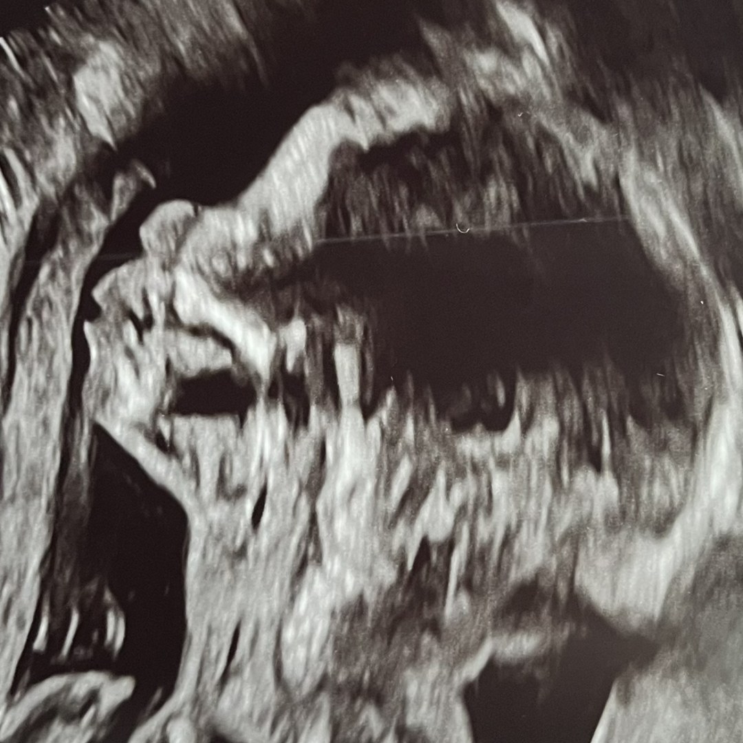 Photo shared by Isabella for their Babylist baby registry.