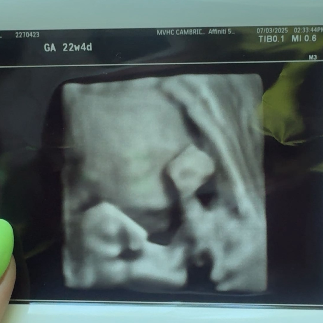 Photo shared by IZABEL for their Babylist baby registry.