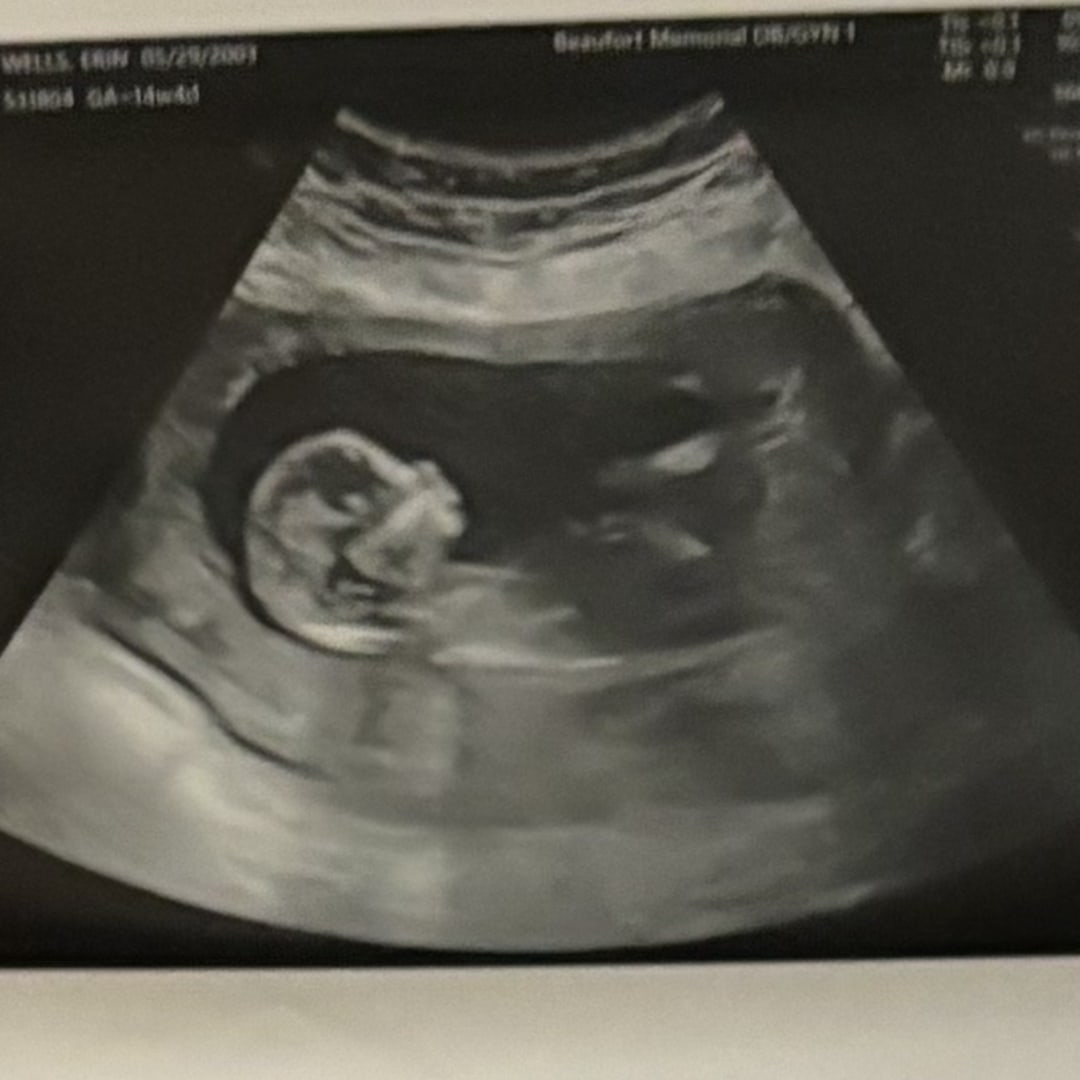 Photo shared by Erin for their Babylist baby registry.