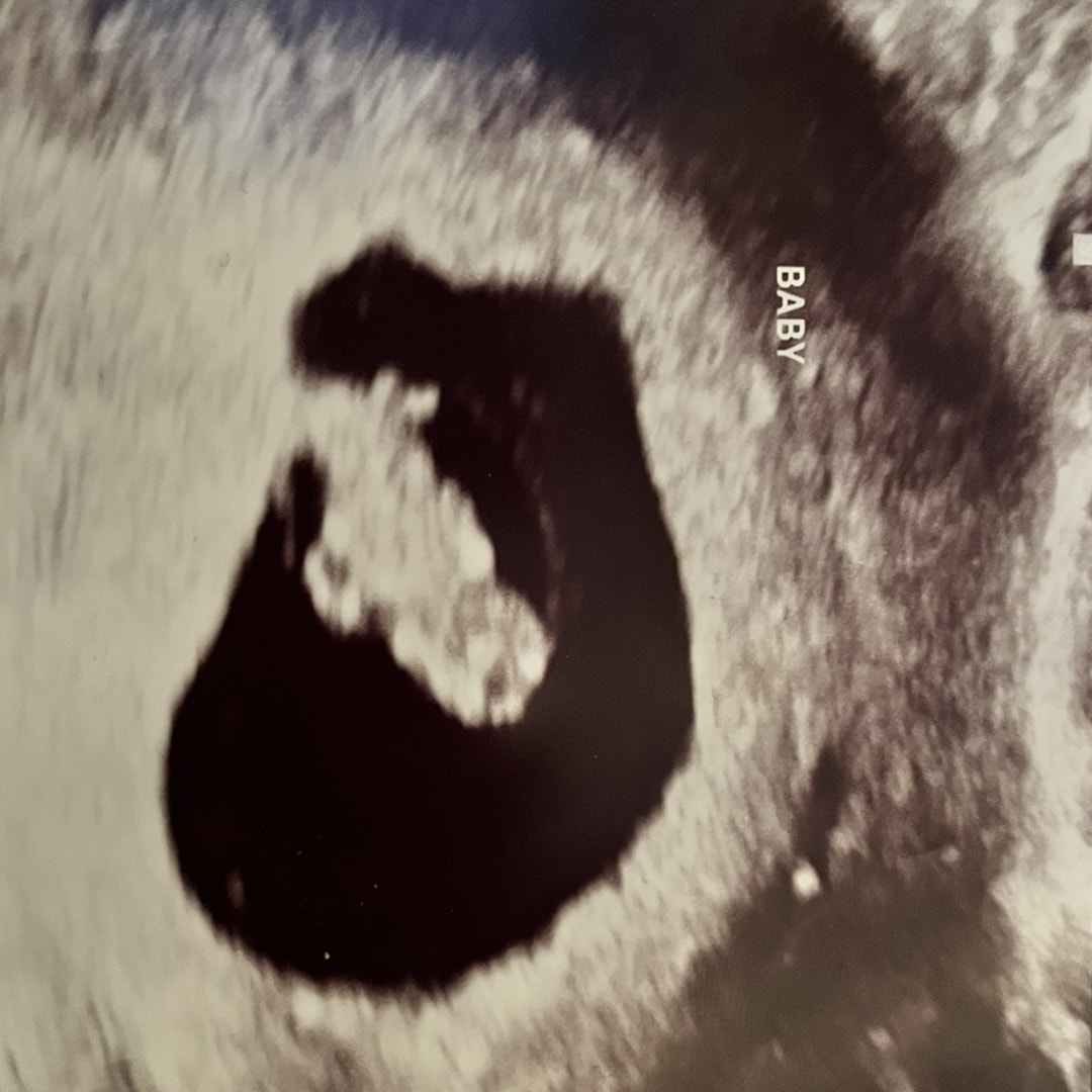 Photo shared by Emily for their Babylist baby registry.
