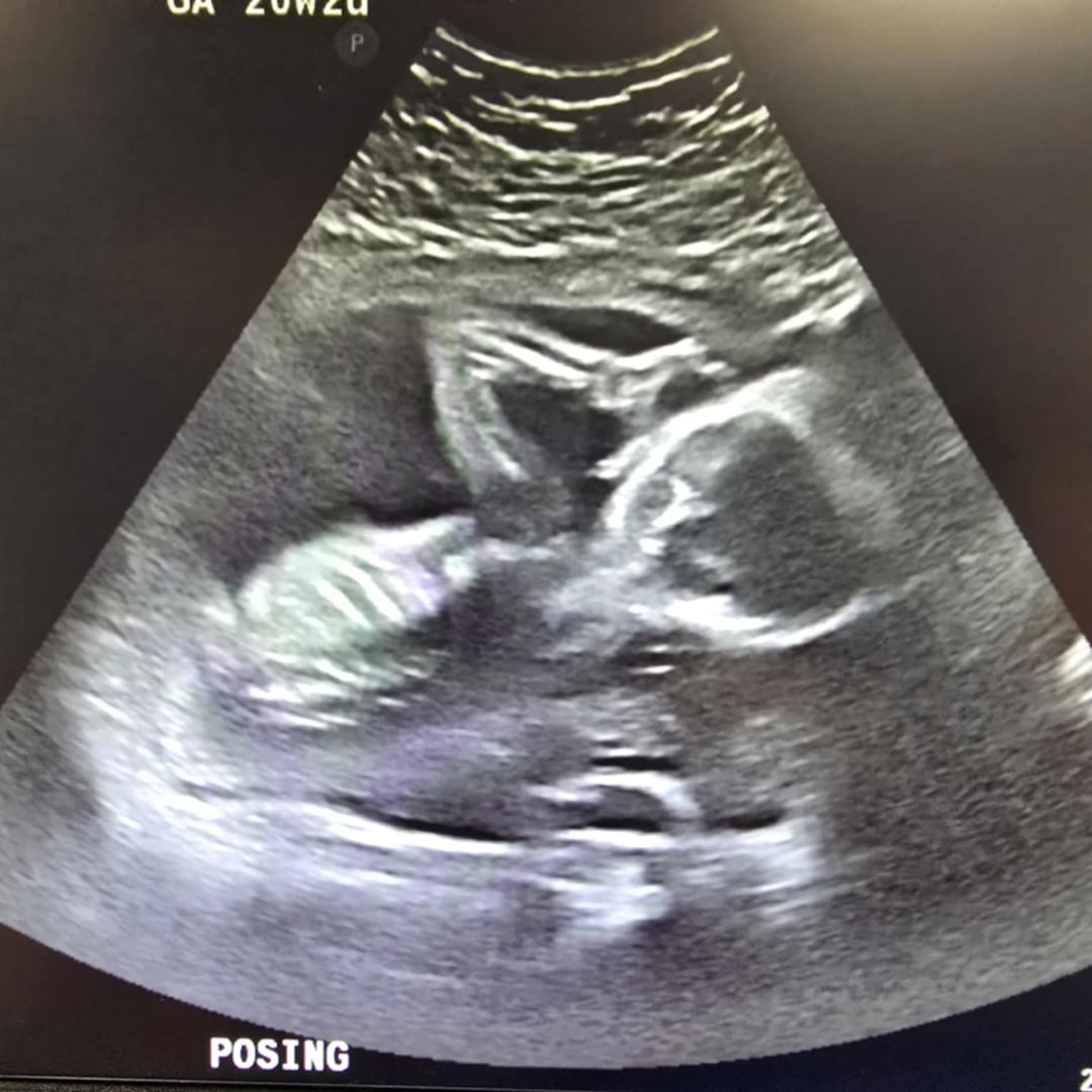 Photo shared by Alanis for their Babylist baby registry.