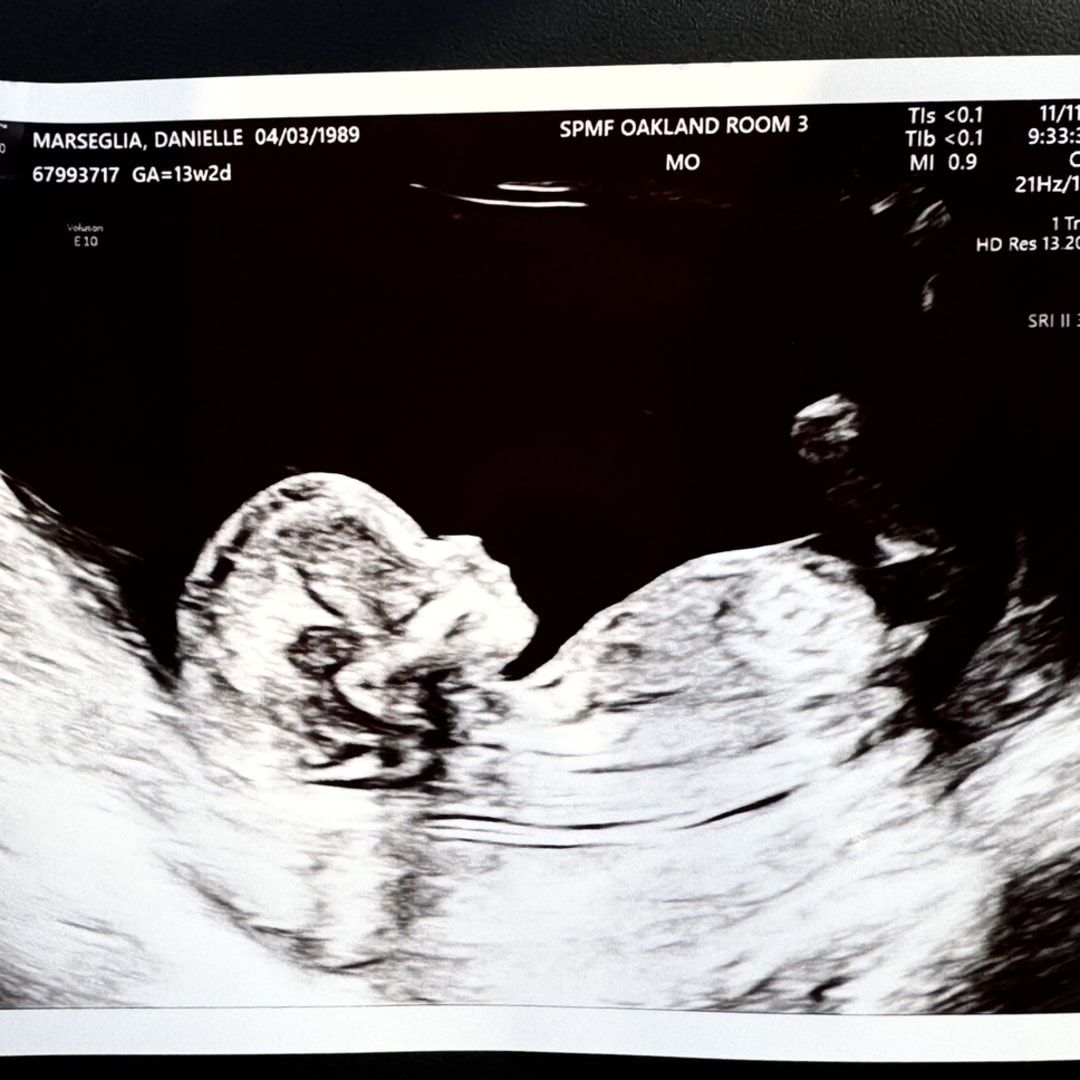 Photo shared by Danielle for their Babylist baby registry.