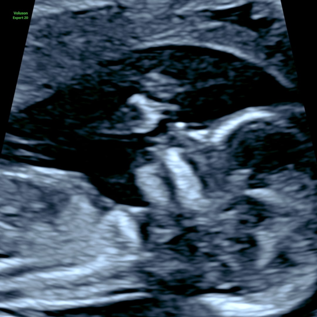 Photo shared by Rebecea for their Babylist baby registry.