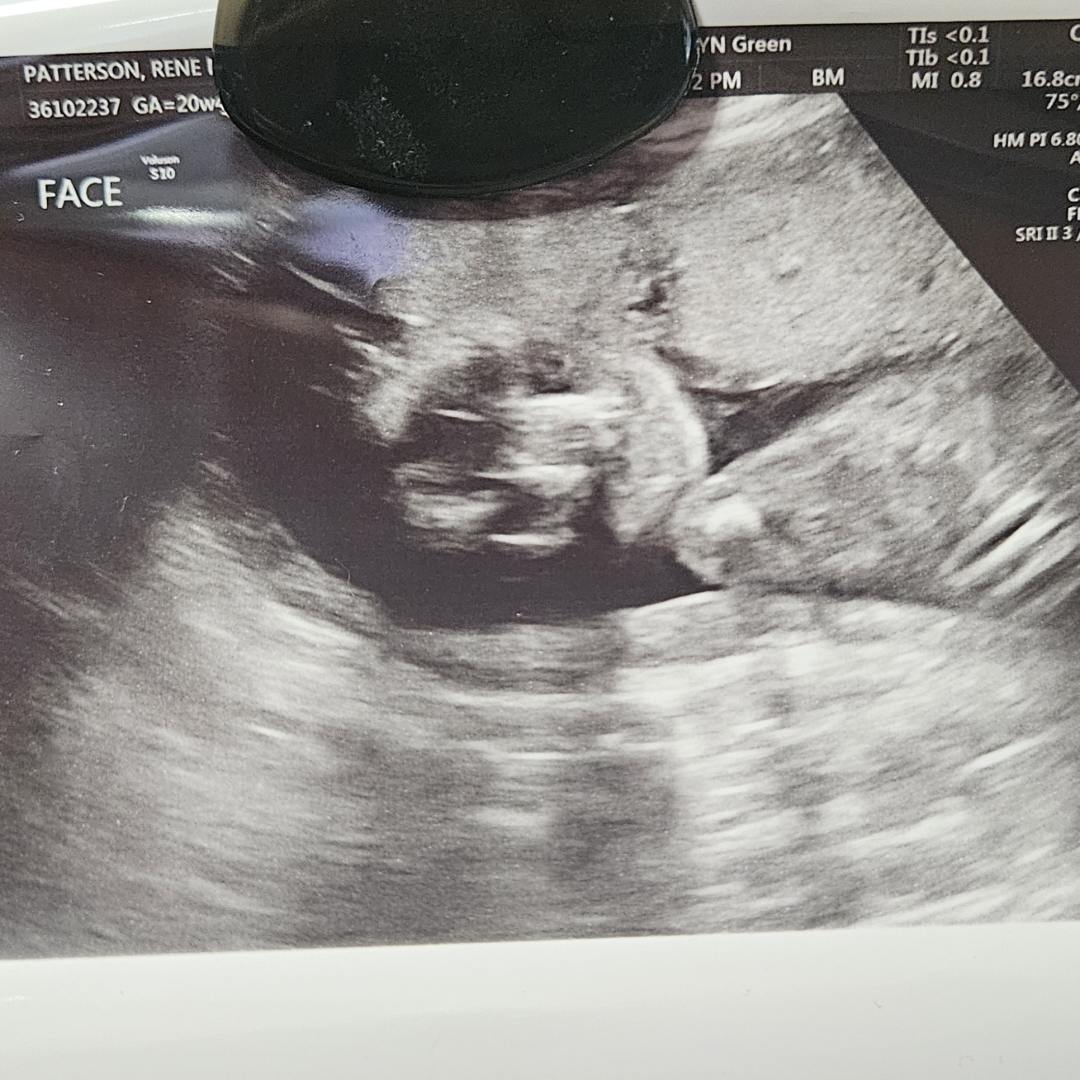 Photo shared by Rene for their Babylist baby registry.