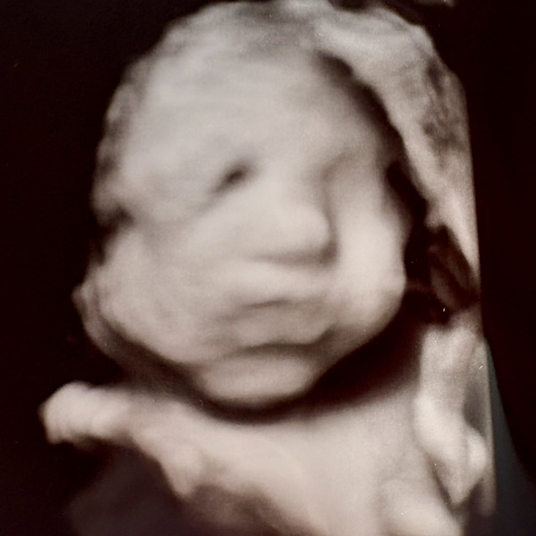 Photo shared by Alaina for their Babylist baby registry.