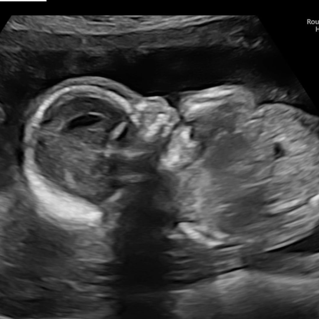 Photo shared by Kaitlyn for their Babylist baby registry.