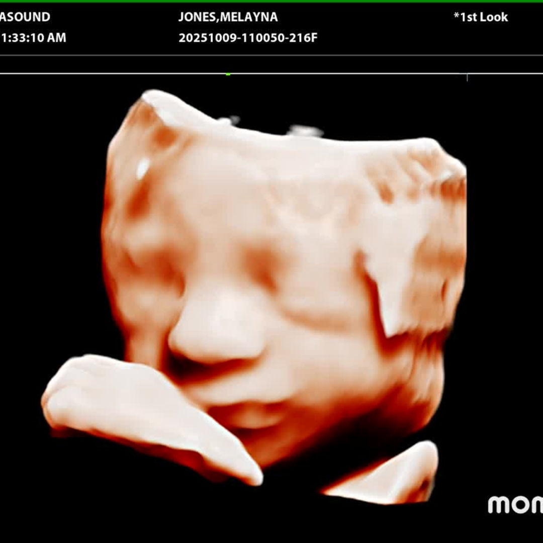 Photo shared by Melayna for their Babylist baby registry.