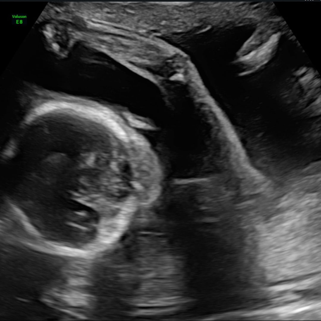 Photo shared by Bridgette for their Babylist baby registry.