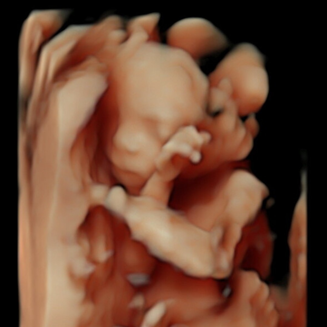 Photo shared by Ashley for their Babylist baby registry.