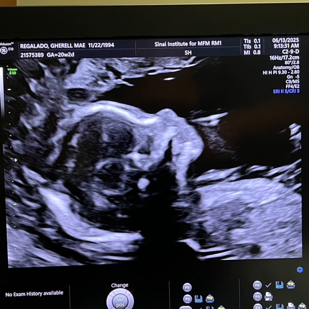Photo shared by Gherell Mae for their Babylist baby registry.