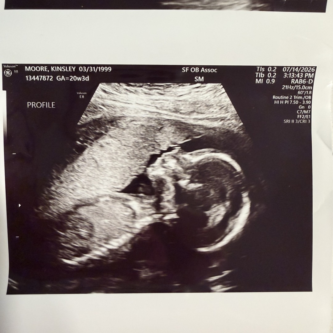 Photo shared by Kinsley for their Babylist baby registry.