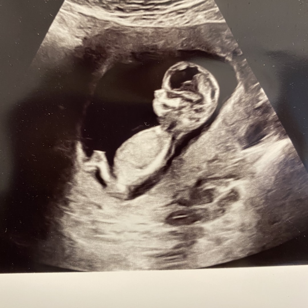 Photo shared by Caroline for their Babylist baby registry.