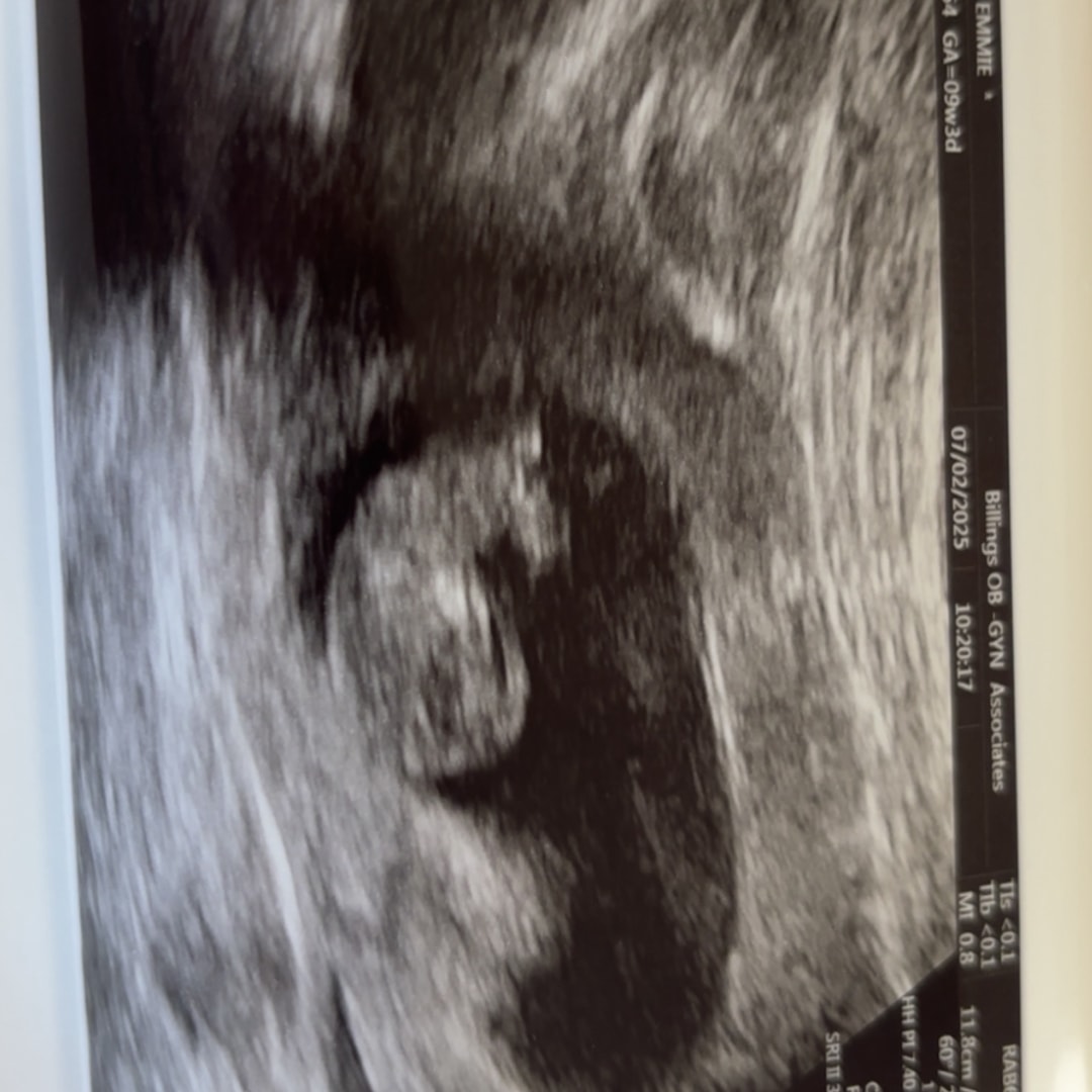 Photo shared by Emmie-Rai for their Babylist baby registry.