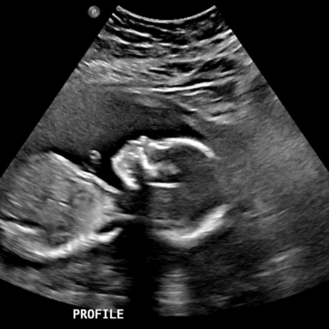 Photo shared by Claira for their Babylist baby registry.