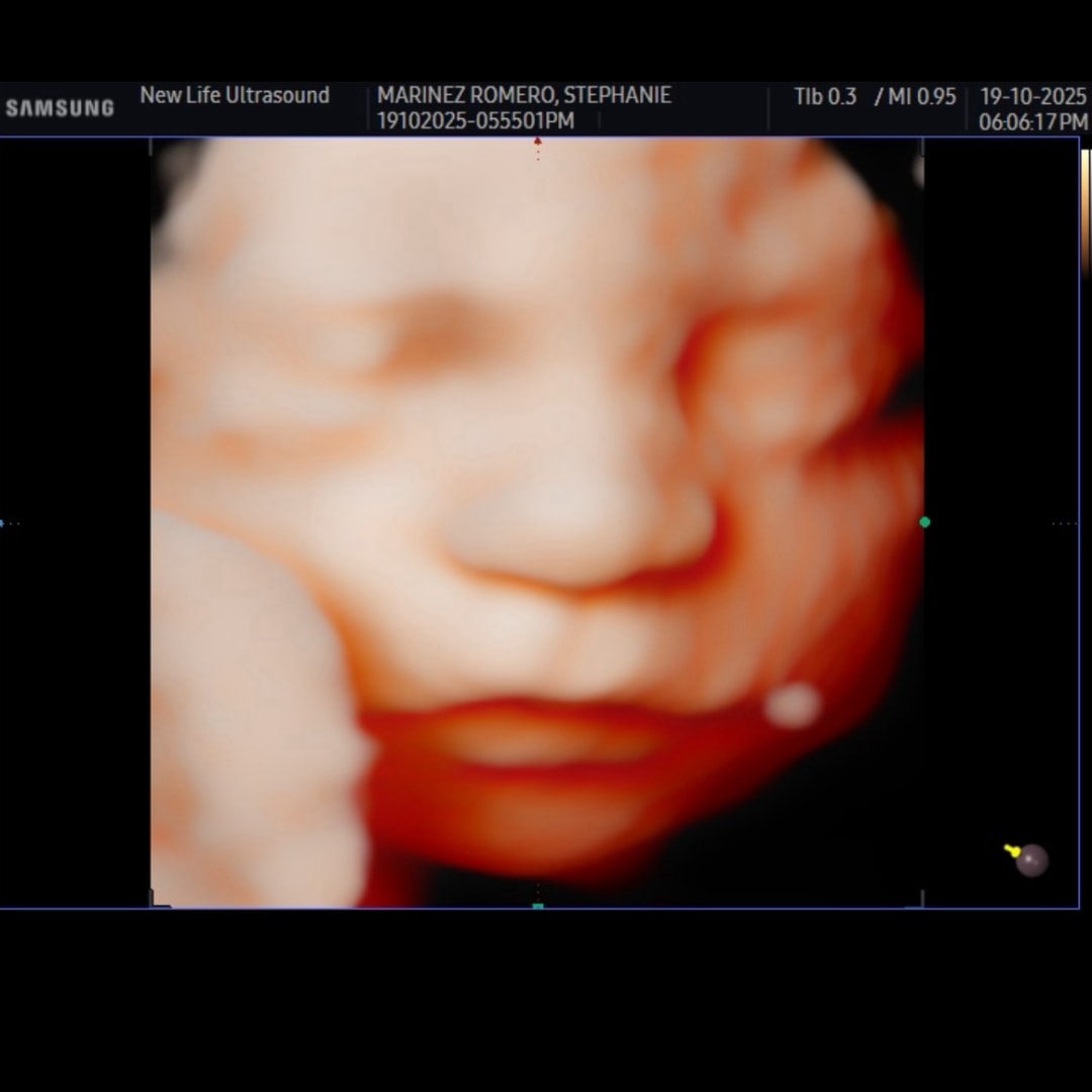 Photo shared by Stephanie for their Babylist baby registry.