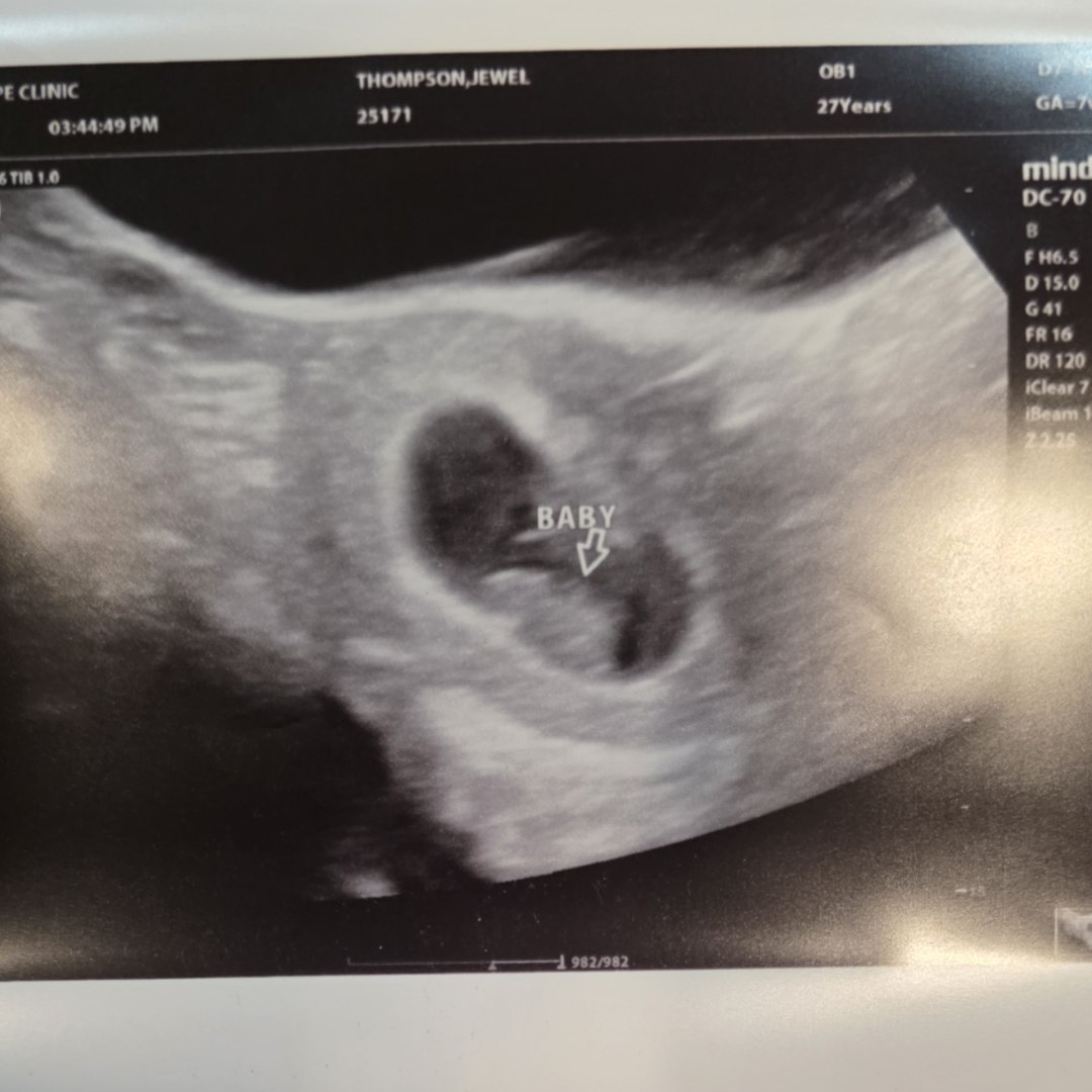 Photo shared by Jewel for their Babylist baby registry.