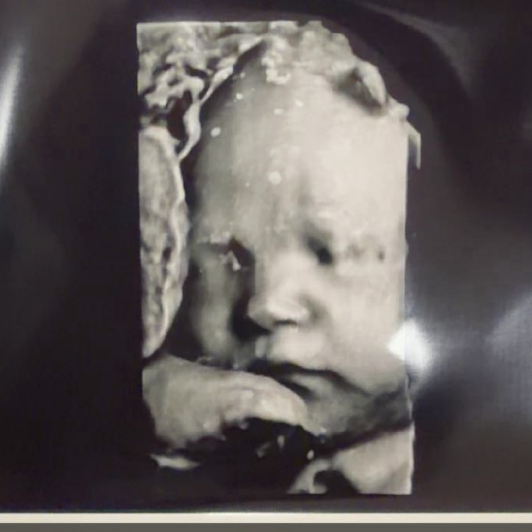 Photo shared by Haley for their Babylist baby registry.