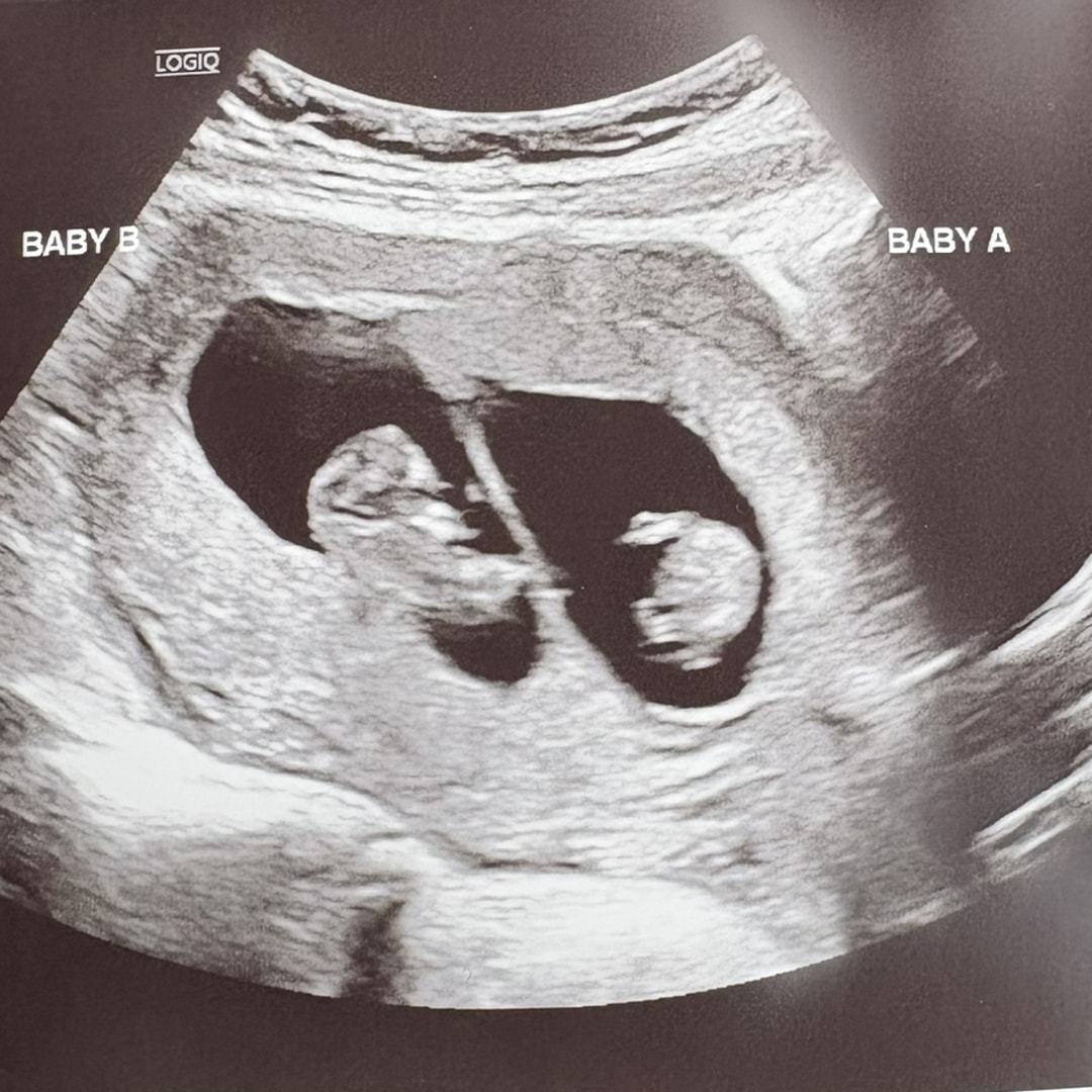 Photo shared by Monica for their Babylist baby registry.