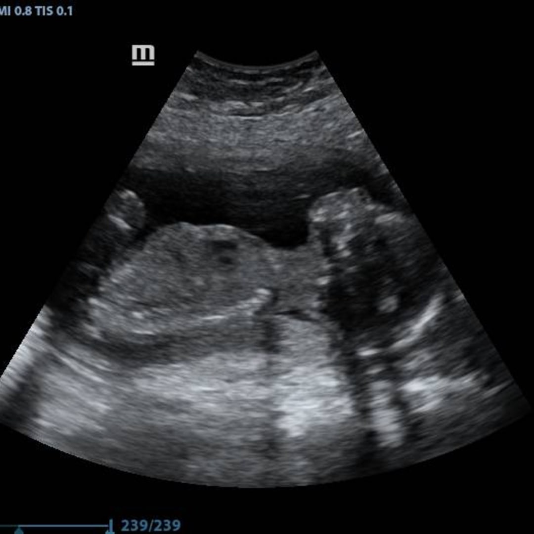 Photo shared by Leigha for their Babylist baby registry.