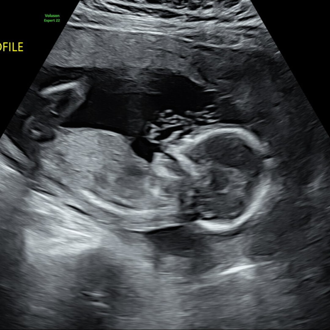 Photo shared by Hayli for their Babylist baby registry.