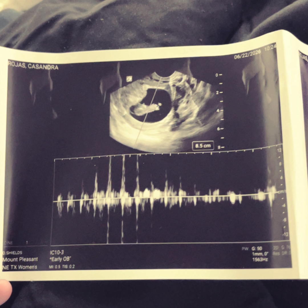 Photo shared by Casandra for their Babylist baby registry.