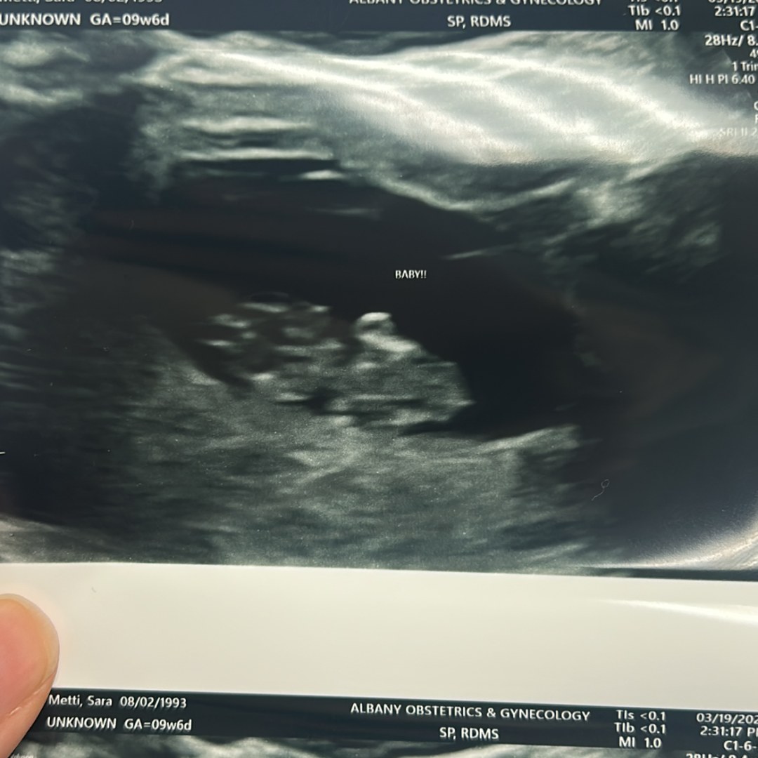 Photo shared by Angel for their Babylist baby registry.