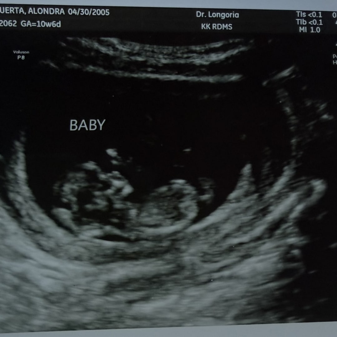 Photo shared by Alondra for their Babylist baby registry.
