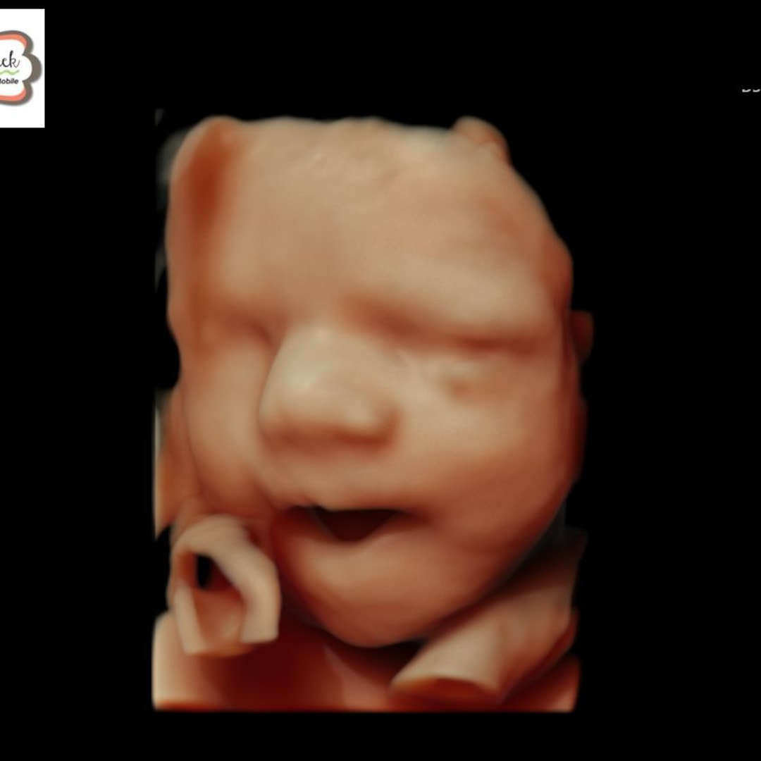Photo shared by Bailey for their Babylist baby registry.