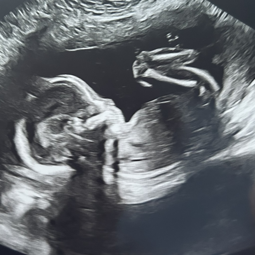 Photo shared by Gretchen for their Babylist baby registry.